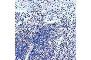 Immunohistochemistry of paraffin-embedded human appendix using A Rabbit mAb (ABIN7265387) at dilution of 1:100 (40x lens). (BAF53A anticorps)