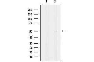 anti-Carboxypeptidase M (CPM) (Internal Region) antibody