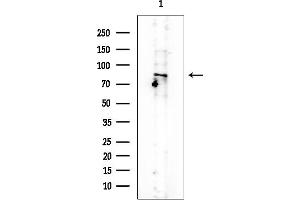 anti-Myotubularin Related Protein 8 (MTMR8) antibody