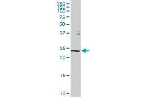 GSTZ1 MaxPab rabbit polyclonal antibody. (GSTZ1 anticorps  (AA 1-216))