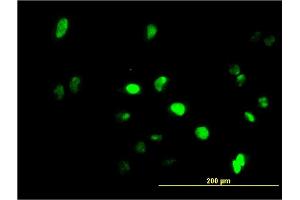 Immunofluorescence of monoclonal antibody to GFI1 on HeLa cell.
