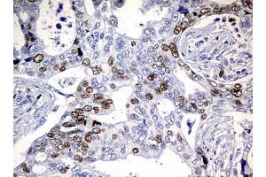 Image no. 5 for anti-Antigen Identified By Monoclonal Antibody Ki-67 (MKI67) (AA 1160-1493) antibody (ABIN1490857) (Ki-67 anticorps  (AA 1160-1493))