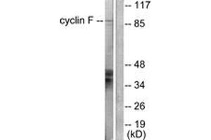 Western blot analysis of extracts from HeLa cells, using Cyclin F Antibody. (Cyclin F anticorps  (AA 737-786))