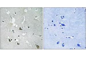 Immunohistochemistry analysis of paraffin-embedded human brain, using TIRAP (Phospho-Tyr86) Antibody. (TIRAP anticorps  (pTyr86))