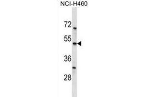 Western Blotting (WB) image for anti-Potassium Channel, Subfamily K, Member 12 (KCNK12) antibody (ABIN3000027) (KCNK12 anticorps)