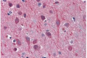 Human Brain, Cortex: Formalin-Fixed, Paraffin-Embedded (FFPE) (TUBB2A anticorps  (AA 1-446))