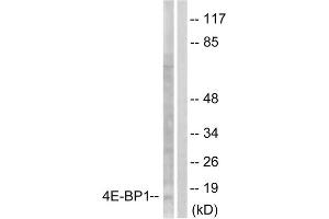 Western blot analysis of extracts from Jurkat cells, treated with Insulin (0. (eIF4EBP1 anticorps  (Ser65))