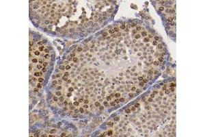 Immunohistochemistry analysis of paraffin-embedded mouse testis using CNOT8 (ABIN7073363) at dilution of 1: 800 (CNOT8 anticorps)