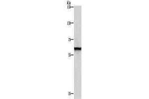 Western Blotting (WB) image for anti-Thyroid Hormone Receptor Interactor 4 (TRIP4) antibody (ABIN2429536) (TRIP4 anticorps)
