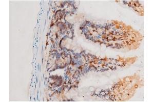 ABIN6267524 at 1/200 staining Mouse intestinal tissue sections by IHC-P.