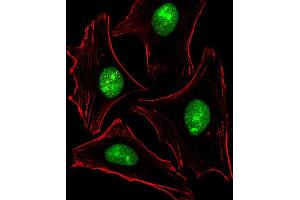 Fluorescent image of Hela cells stained with XAF1 PTK2B Antibody (C-term) (ABIN6243517 and ABIN6577462). (PTK2B anticorps  (C-Term))