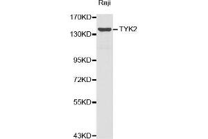 Western blot analysis of extracts of Raji cell lines, using TYK2 antibody.
