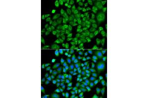 Immunofluorescence analysis of A549 cells using NAA50 antibody. (NAA50 anticorps  (AA 1-169))