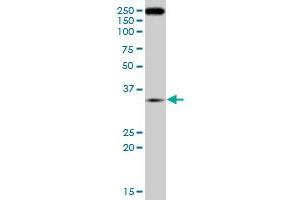 RNF2 monoclonal antibody (M09), clone 4A12. (RNF2 anticorps  (AA 192-290))