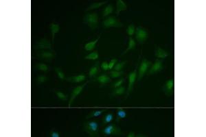 Immunofluorescence analysis of MCF-7 cells using LIG1 Polyclonal Antibody