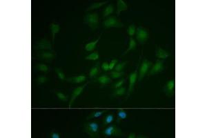 Immunofluorescence analysis of MCF-7 cells using LIG1 Polyclonal Antibody (LIG1 anticorps)