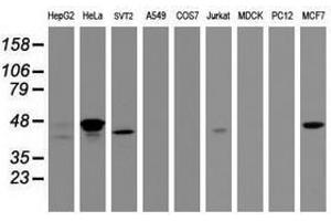 Image no. 2 for anti-Chromobox Homolog 8 (CBX8) (AA 1-260) antibody (ABIN1490666) (CBX8 anticorps  (AA 1-260))