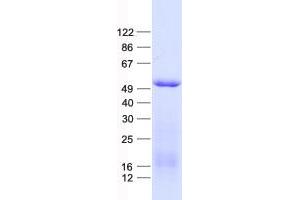 Validation with Western Blot