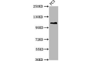 Western Blot Positive WB detected in: PC-3 whole cell lysate All lanes: FAN1 antibody at 5. (FAN1 anticorps  (AA 167-373))