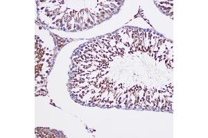 Immunohistochemistry of paraffin-embedded Rat testis using TUBGCP6 Rabbit pAb (ABIN7271055) at dilution of 1:100 (20x lens).