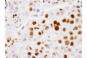 anti-Proline-, Glutamic Acid- and Leucine-Rich Protein 1 (PELP1) (AA 1000-1050) antibody