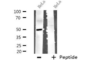 Western blot analysis of extracts from HeLa cells using MYLIP antibody. (MYLIP anticorps  (Internal Region))