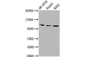 Western Blot Positive WB detected in: SH-SY5Y whole cell lysate, HepG2 whole cell lysate, K562 whole cell lysate All lanes: ULK2 antibody at 2. (ULK2 anticorps  (AA 211-276))