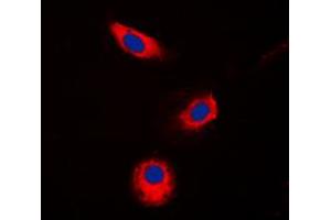 Immunofluorescent analysis of Aldose Reductase staining in Jurkat cells. (AKR1B1 anticorps  (C-Term))