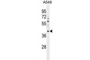 Western Blotting (WB) image for anti-Myosin Binding Protein H-Like (MYBPHL) antibody (ABIN2996396) (MYBPHL anticorps)