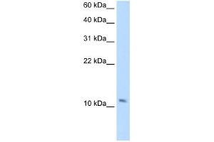 SMPX antibody used at 2. (SMPX anticorps  (Middle Region))