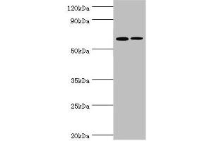 Western blot All lanes: IL27RA antibody at 9 μg/mL Lane 1: Rat heart tissue Lane 2: Rat brain tissue Secondary Goat polyclonal to rabbit IgG at 1/10000 dilution Predicted band size: 69 kDa Observed band size: 69 kDa (IL27 Receptor alpha anticorps  (AA 33-283))