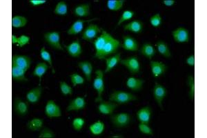 Immunofluorescence staining of A549 cells with ABIN7160623 at 1:166, counter-stained with DAPI.