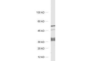 dilution: 1 : 1000, sample: rat brain homogenate (GPM6A anticorps)