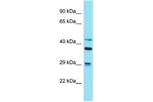Western Blotting (WB) image for anti-Striatin, Calmodulin Binding Protein 3 (STRN3) (N-Term) antibody (ABIN2789947) (STRN3 anticorps  (N-Term))