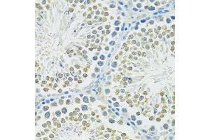 Immunohistochemistry of paraffin-embedded mouse testis using SLC1A4 antibody.