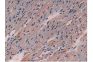 Detection of CHD3 in Mouse Heart Tissue using Polyclonal Antibody to Chromodomain Helicase DNA Binding Protein 3 (CHD3)