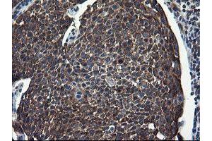 Image no. 5 for anti-CCR4-NOT Transcription Complex Subunit 4 (CNOT4) (AA 190-455) antibody (ABIN1491098) (CNOT4 anticorps  (AA 190-455))