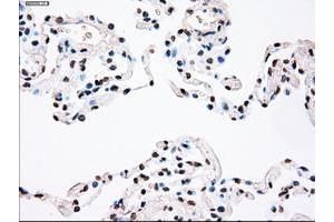 Image no. 7 for anti-Polo-Like Kinase 1 (PLK1) antibody (ABIN1500282)