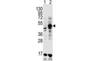 Western Blotting (WB) image for anti-Growth Differentiation Factor 9 (GDF9) antibody (ABIN3001444) (GDF9 anticorps)