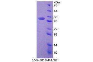 SDS-PAGE (SDS) image for Nerve Growth Factor (NGF) (AA 19-239) protein (His tag) (ABIN2126033)