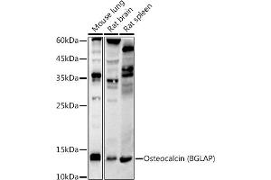 Western blot analysis of extracts of various cell lines, using Osteocalcin (BGLAP) antibody (ABIN7269118) at 1:1000 dilution. (Osteocalcin anticorps)
