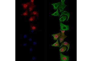 Phospho-JIP1 (Thr205) Antibody staining Hela cells(heat shock treatment) by IF/ICC. (MAPK8IP1 anticorps  (pThr205))