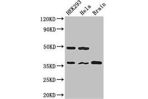 Western Blot Positive WB detected in: HEK293 whole cell lysate, Hela whole cell lysate, Mouse brain tissue All lanes: PPP1CC antibody at 2.