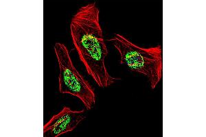 Fluorescent confocal image of Hela cell stained with NR2C2 Antibody . (TR4 anticorps  (C-Term))