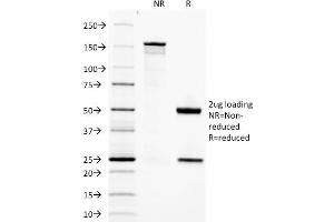 SDS-PAGE Analysis Purified Adiponectin Mouse Monoclonal Antibody (ADPN/1370). (ADIPOQ anticorps  (AA 145-226))