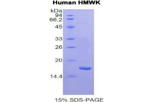 SDS-PAGE analysis of Human HMWK Protein. (Kininogen (HMW) Protéine)