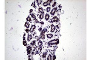 Image no. 9 for anti-Nibrin (NBN) (AA 183-460) antibody (ABIN1491058)