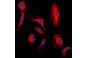 Immunofluorescent analysis of WNT1 staining in H9C2 cells.