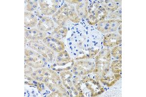 Immunohistochemistry of paraffin-embedded rat kidney using HD antibody (ABIN3022456, ABIN3022457, ABIN3022458 and ABIN6218830) at dilution of 1:100 (40x lens).