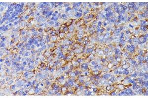 Immunohistochemistry of paraffin-embedded Rat lymph node using SNAP23 Polyclonal Antibody at dilution of 1:100 (40x lens).